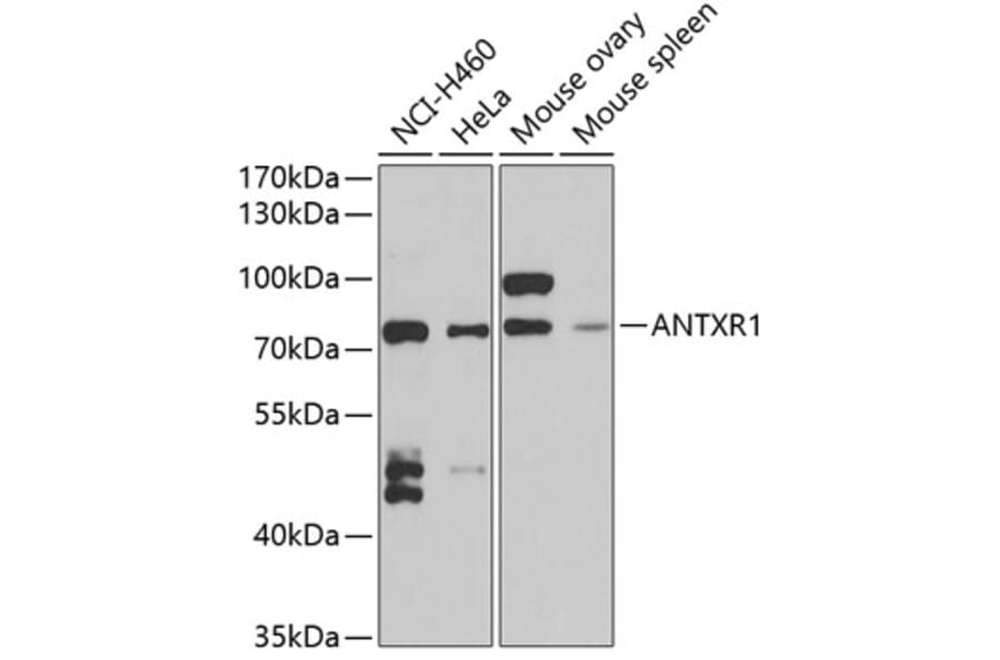 Western Blot - Anti-TEM8/ATR Antibody (A15262) - Antibodies.com