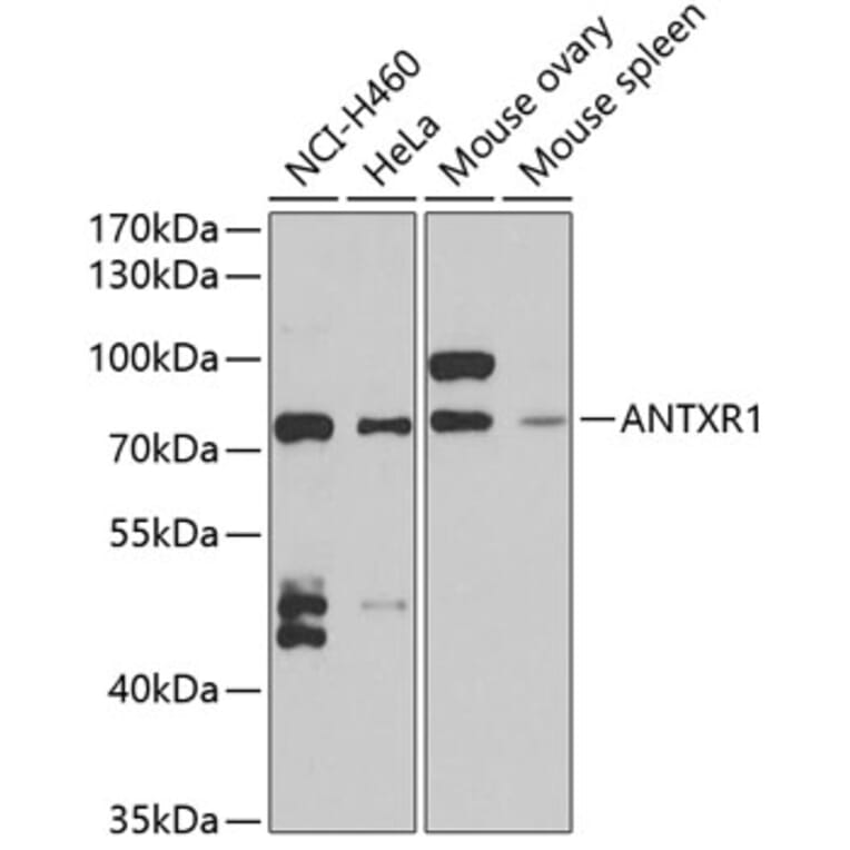 Western Blot - Anti-TEM8/ATR Antibody (A15262) - Antibodies.com