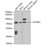 Western Blot - Anti-TEM8/ATR Antibody (A15262) - Antibodies.com