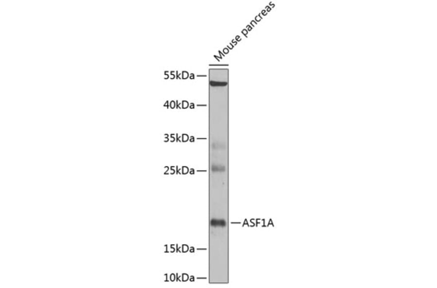 Western Blot - Anti-ASF1A Antibody (A6528) - Antibodies.com