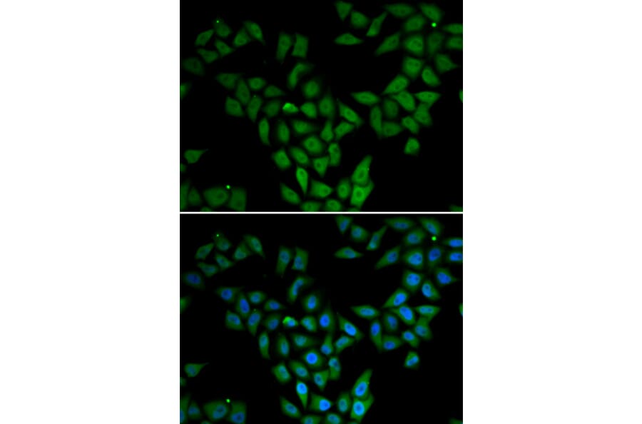 Immunofluorescence - Anti-ASF1A Antibody (A6528) - Antibodies.com