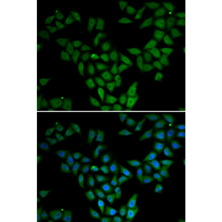 Immunofluorescence - Anti-ASF1A Antibody (A6528) - Antibodies.com