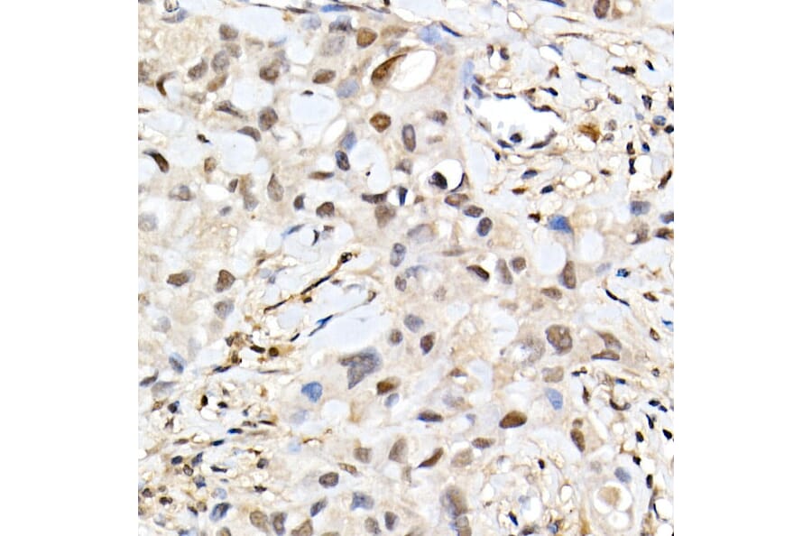 Immunohistochemistry - Anti-BAP1 Antibody (A15264) - Antibodies.com