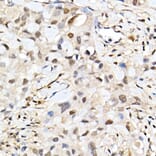 Immunohistochemistry - Anti-BAP1 Antibody (A15264) - Antibodies.com