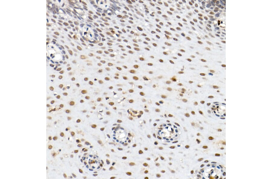 Immunohistochemistry - Anti-BAP1 Antibody (A15264) - Antibodies.com