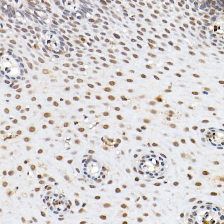 Immunohistochemistry - Anti-BAP1 Antibody (A15264) - Antibodies.com