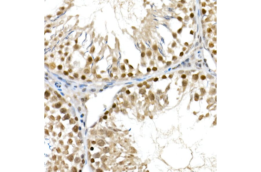 Immunohistochemistry - Anti-BAP1 Antibody (A15264) - Antibodies.com