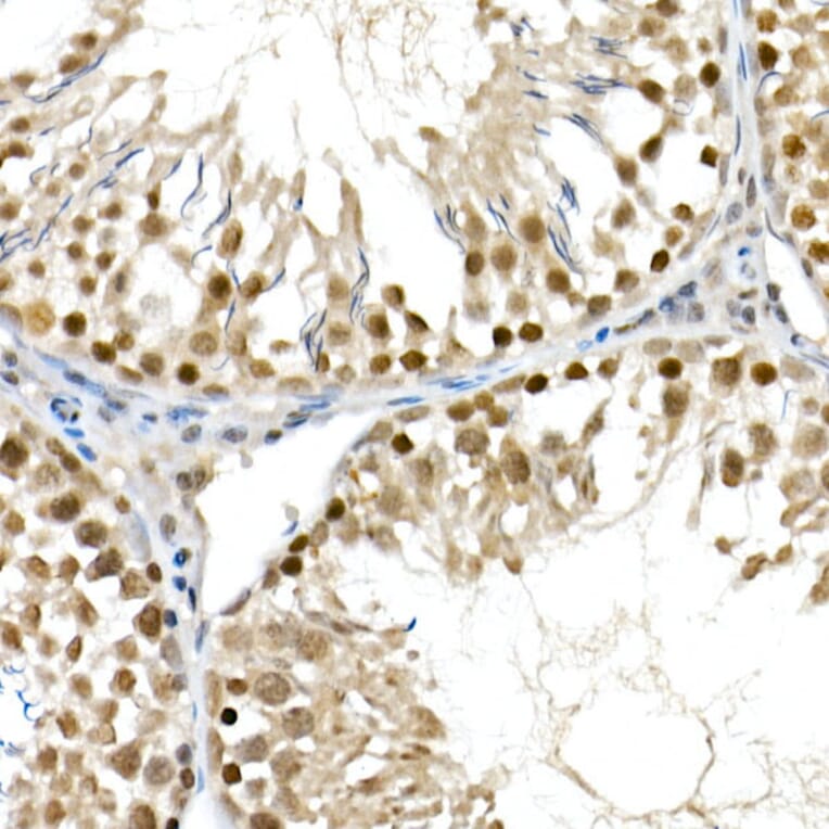 Immunohistochemistry - Anti-BAP1 Antibody (A15264) - Antibodies.com