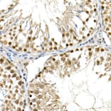 Immunohistochemistry - Anti-BAP1 Antibody (A15264) - Antibodies.com