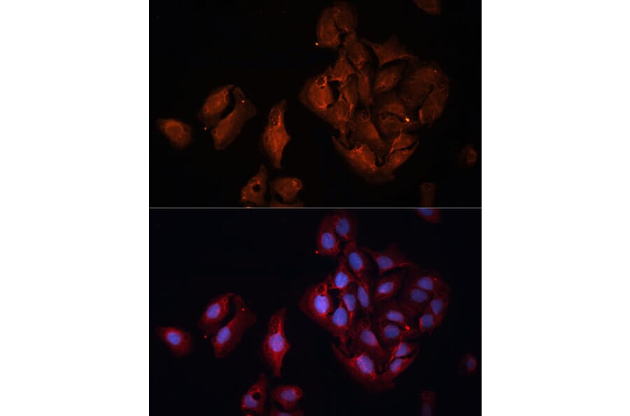 Immunofluorescence - Anti-BAP1 Antibody (A15264) - Antibodies.com