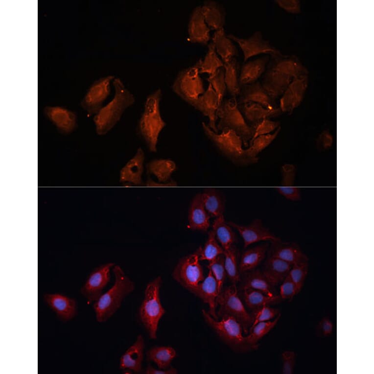 Immunofluorescence - Anti-BAP1 Antibody (A15264) - Antibodies.com