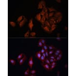 Immunofluorescence - Anti-BAP1 Antibody (A15264) - Antibodies.com