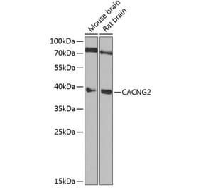 Western Blot - Anti-Stargazin Antibody (A15266) - Antibodies.com