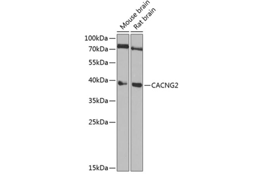 Western Blot - Anti-Stargazin Antibody (A15266) - Antibodies.com