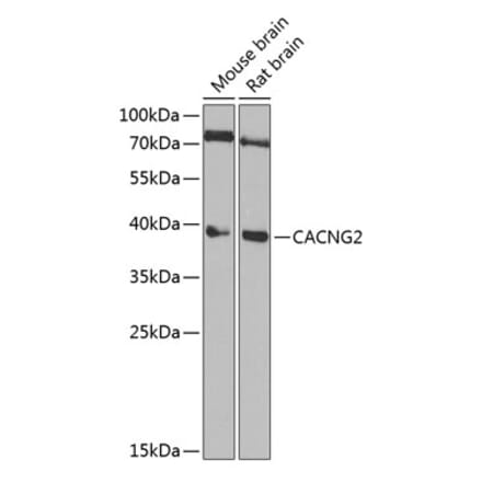 Western Blot - Anti-Stargazin Antibody (A15266) - Antibodies.com