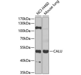 Western Blot - Anti-Calumenin Antibody (A15267) - Antibodies.com