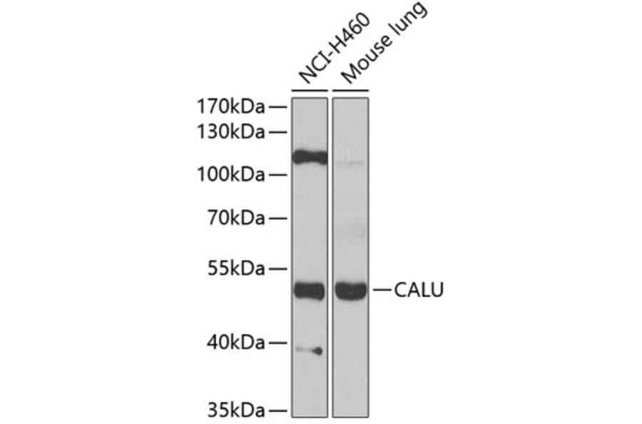 Western Blot - Anti-Calumenin Antibody (A15267) - Antibodies.com