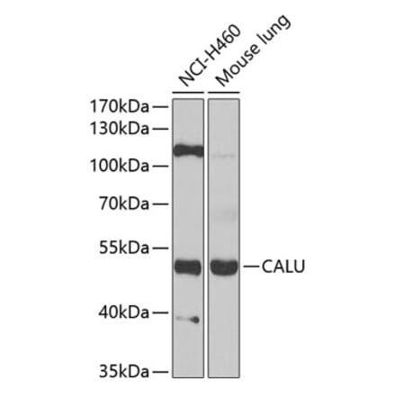 Western Blot - Anti-Calumenin Antibody (A15267) - Antibodies.com