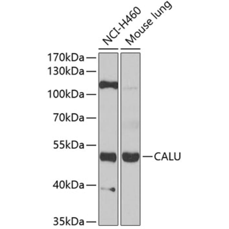 Western Blot - Anti-Calumenin Antibody (A15267) - Antibodies.com