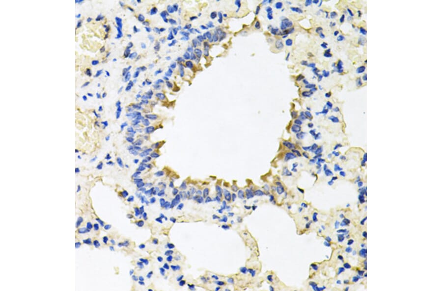 Immunohistochemistry - Anti-Calumenin Antibody (A15267) - Antibodies.com