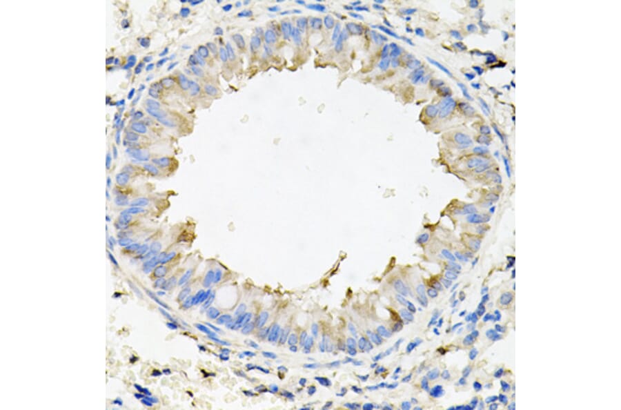 Immunohistochemistry - Anti-Calumenin Antibody (A15267) - Antibodies.com