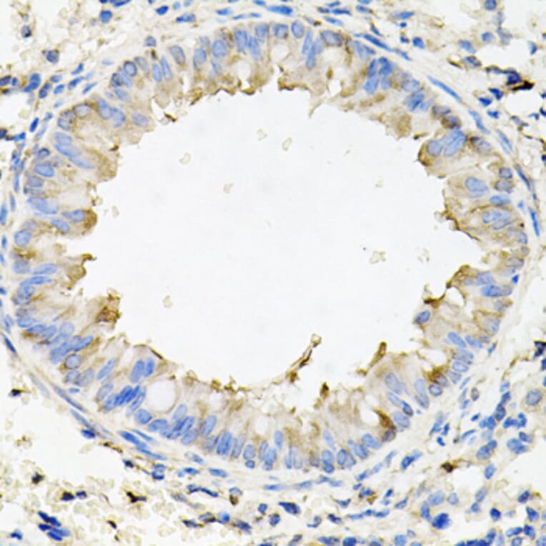 Immunohistochemistry - Anti-Calumenin Antibody (A15267) - Antibodies.com
