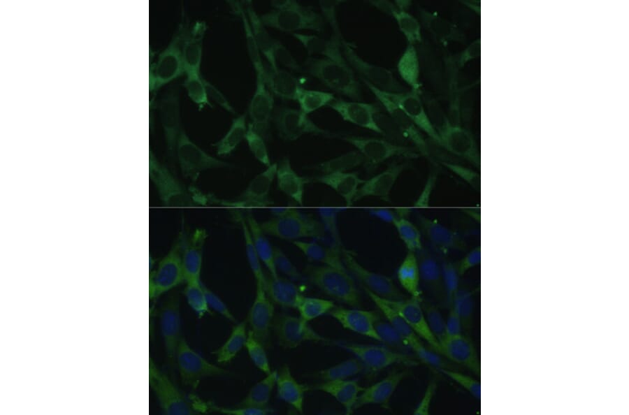 Immunofluorescence - Anti-Calumenin Antibody (A15267) - Antibodies.com