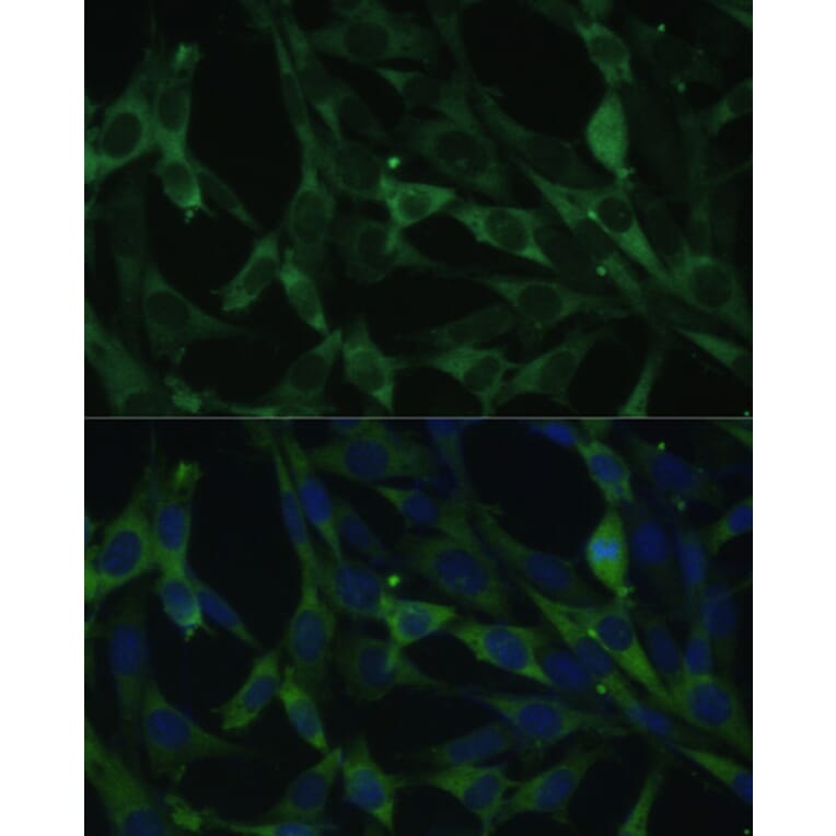 Immunofluorescence - Anti-Calumenin Antibody (A15267) - Antibodies.com