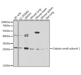 Western Blot - Anti-Calpain small subunit 1 Antibody (A15268) - Antibodies.com