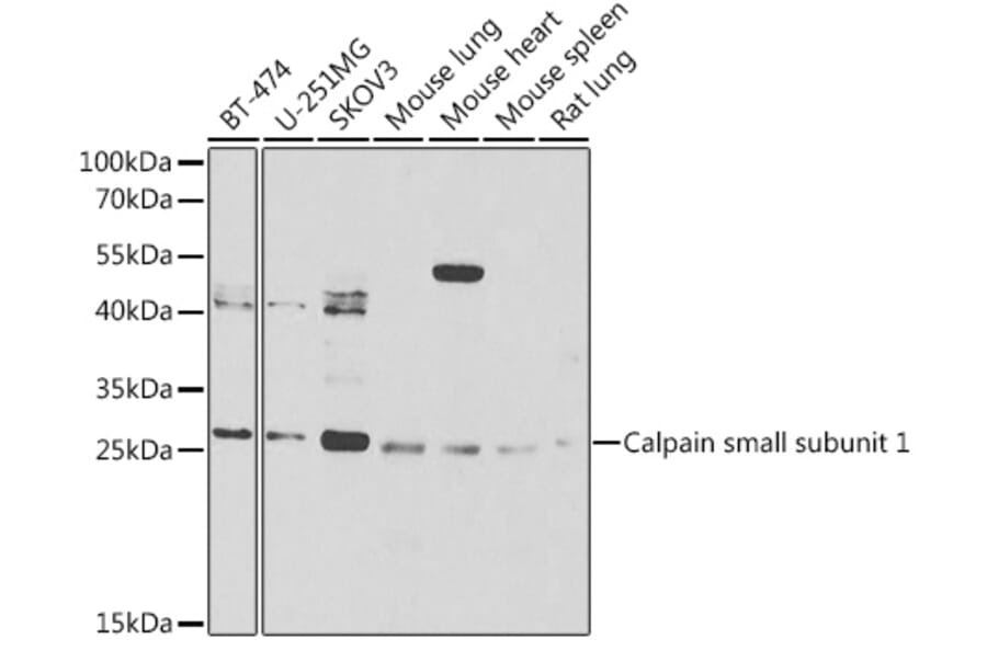 Western Blot - Anti-Calpain small subunit 1 Antibody (A15268) - Antibodies.com
