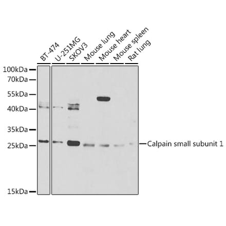 Western Blot - Anti-Calpain small subunit 1 Antibody (A15268) - Antibodies.com