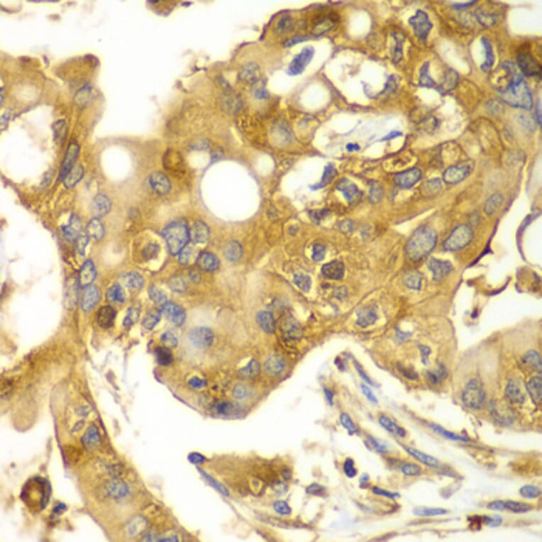 Immunohistochemistry - Anti-Calpain small subunit 1 Antibody (A15268) - Antibodies.com