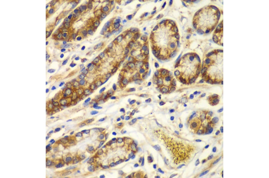 Immunohistochemistry - Anti-Calpain small subunit 1 Antibody (A15268) - Antibodies.com