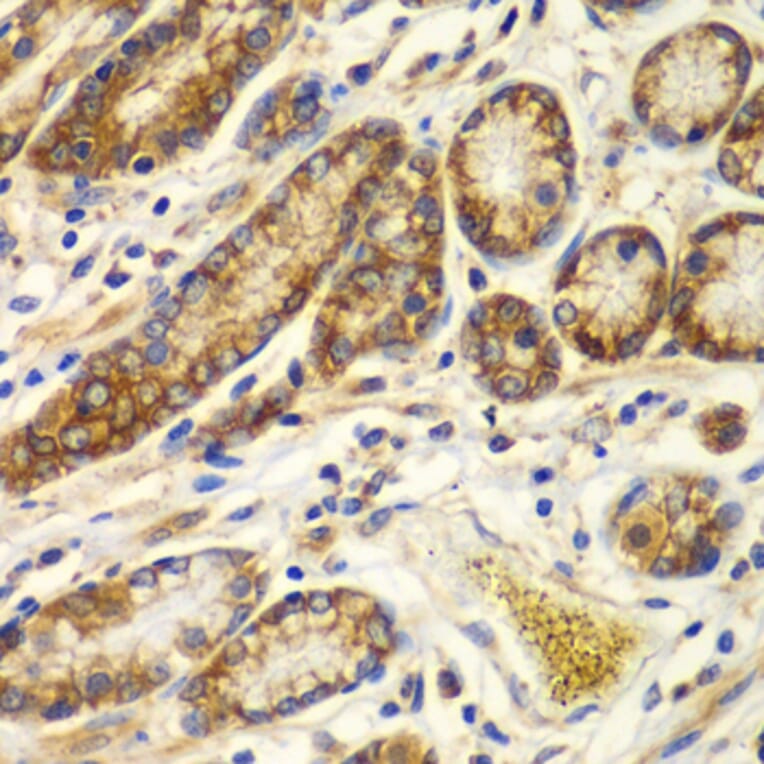 Immunohistochemistry - Anti-Calpain small subunit 1 Antibody (A15268) - Antibodies.com