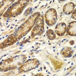 Immunohistochemistry - Anti-Calpain small subunit 1 Antibody (A15268) - Antibodies.com