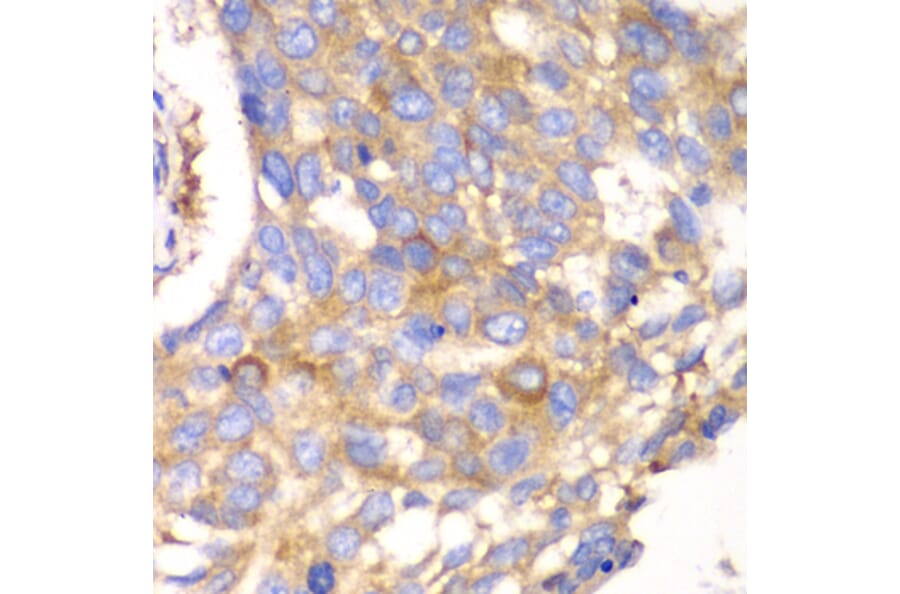 Immunohistochemistry - Anti-Calpain small subunit 1 Antibody (A15268) - Antibodies.com