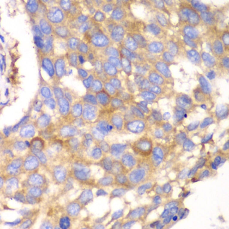 Immunohistochemistry - Anti-Calpain small subunit 1 Antibody (A15268) - Antibodies.com