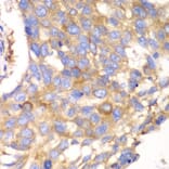 Immunohistochemistry - Anti-Calpain small subunit 1 Antibody (A15268) - Antibodies.com