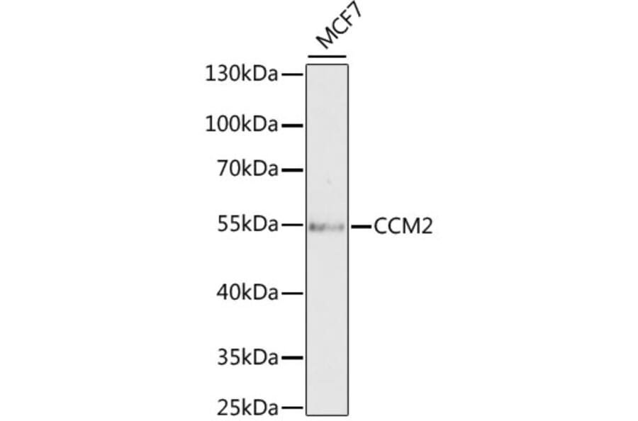 Western Blot - Anti-CCM2 Antibody (A15269) - Antibodies.com