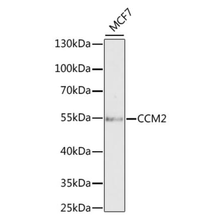 Western Blot - Anti-CCM2 Antibody (A15269) - Antibodies.com