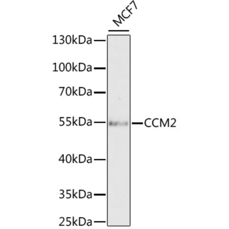 Western Blot - Anti-CCM2 Antibody (A15269) - Antibodies.com