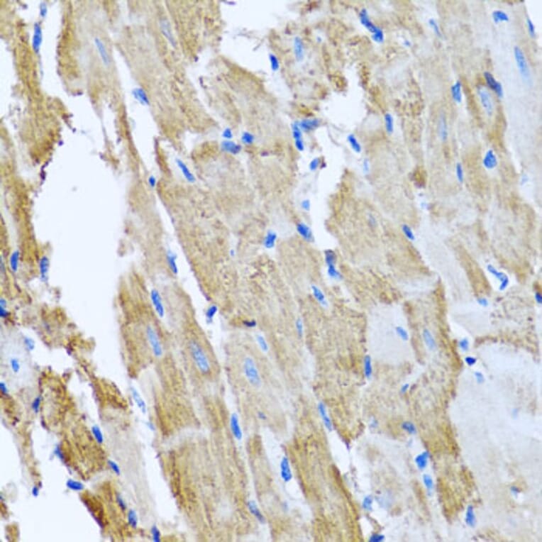 Immunohistochemistry - Anti-CCM2 Antibody (A15269) - Antibodies.com