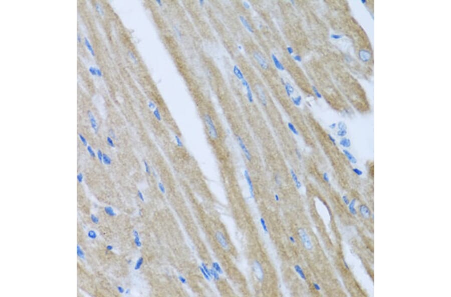 Immunohistochemistry - Anti-CCM2 Antibody (A15269) - Antibodies.com