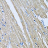 Immunohistochemistry - Anti-CCM2 Antibody (A15269) - Antibodies.com