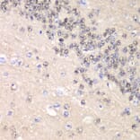 Immunohistochemistry - Anti-Cyclin C Antibody (A15270) - Antibodies.com