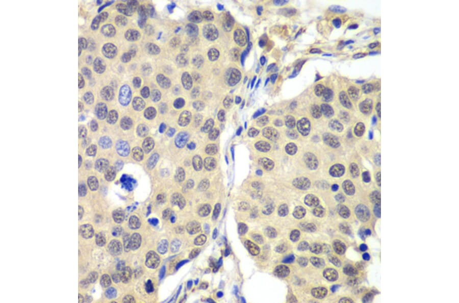 Immunohistochemistry - Anti-Cyclin C Antibody (A15270) - Antibodies.com