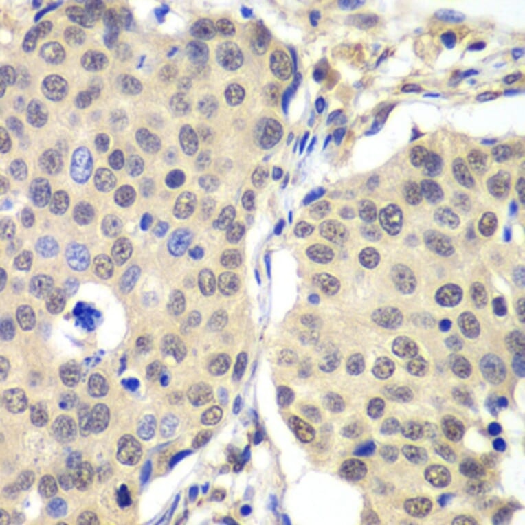 Immunohistochemistry - Anti-Cyclin C Antibody (A15270) - Antibodies.com