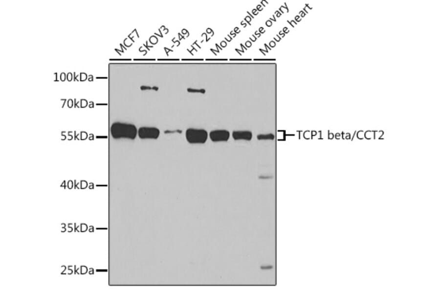 Western Blot - Anti-CCT2 Antibody (A15271) - Antibodies.com