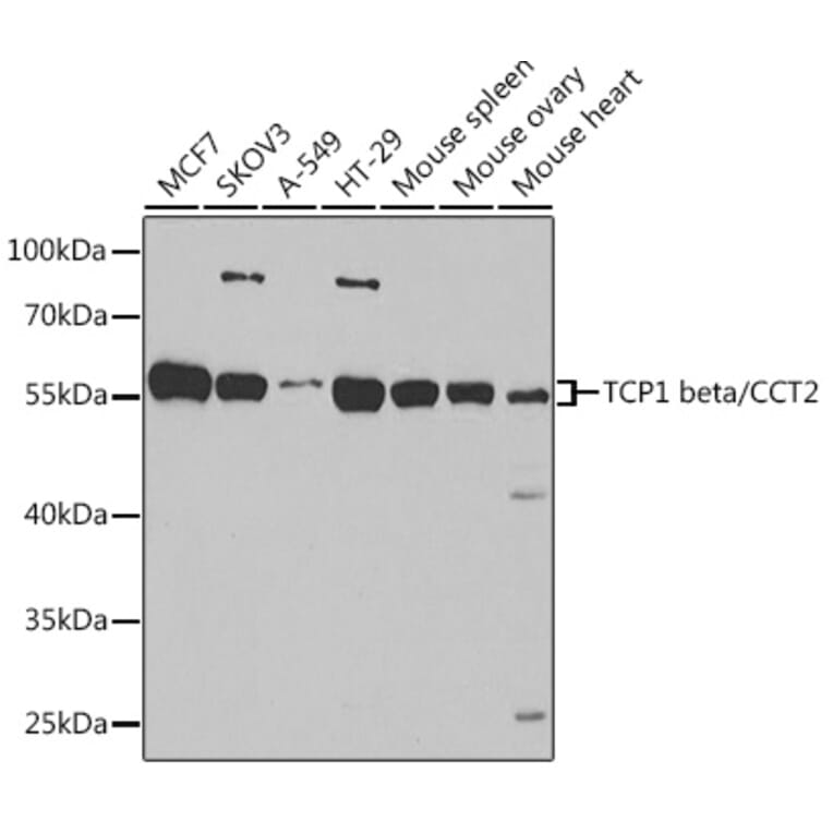 Western Blot - Anti-CCT2 Antibody (A15271) - Antibodies.com