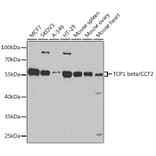 Western Blot - Anti-CCT2 Antibody (A15271) - Antibodies.com